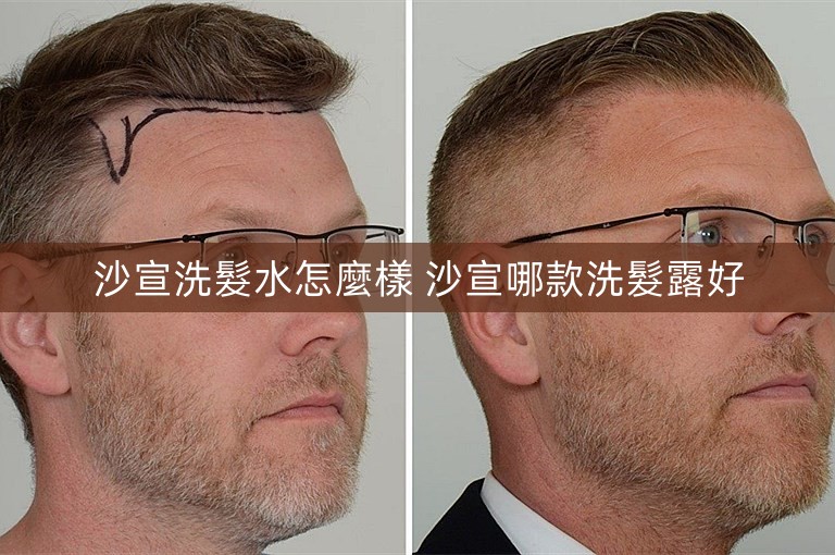 沙宣洗髮水怎麼樣 沙宣哪款洗髮露好