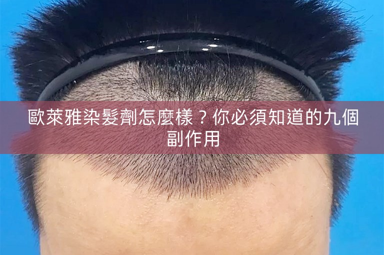 歐萊雅染髮劑怎麼樣？你必須知道的九個副作用