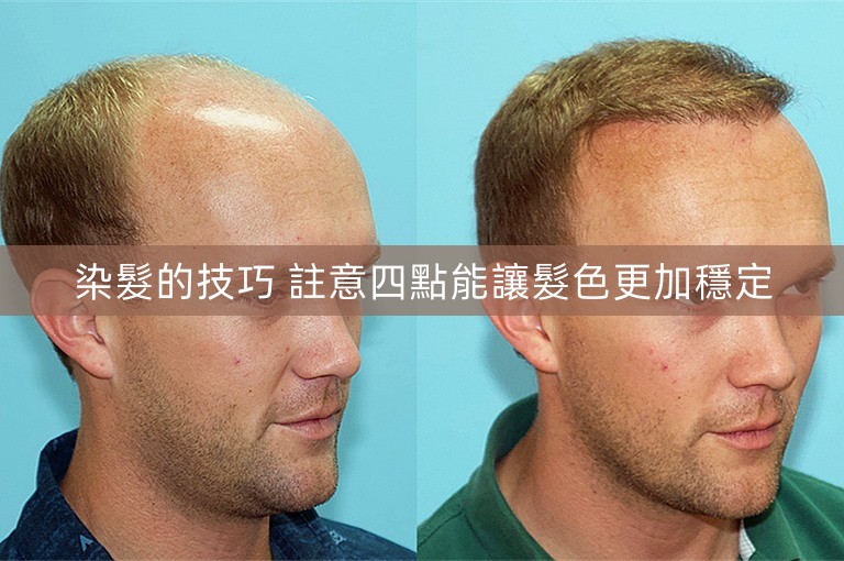 染髮的技巧 註意四點能讓髮色更加穩定 染髮的技巧 註意四點能讓髮色更加穩定