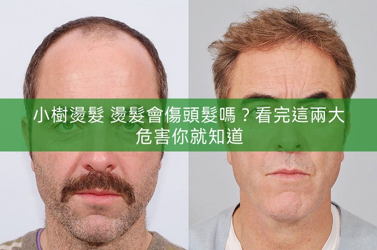 小樹燙髮 燙髮會傷頭髮嗎?看完這兩大危害你就知道 小樹燙髮 燙髮會傷頭髮嗎?看完這兩大危害你就知道