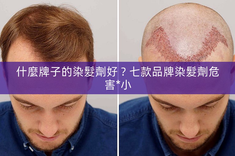 什麼牌子的染髮劑好？七款品牌染髮劑危害*小