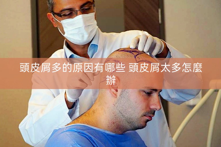 頭皮屑多的原因有哪些 頭皮屑太多怎麼辦