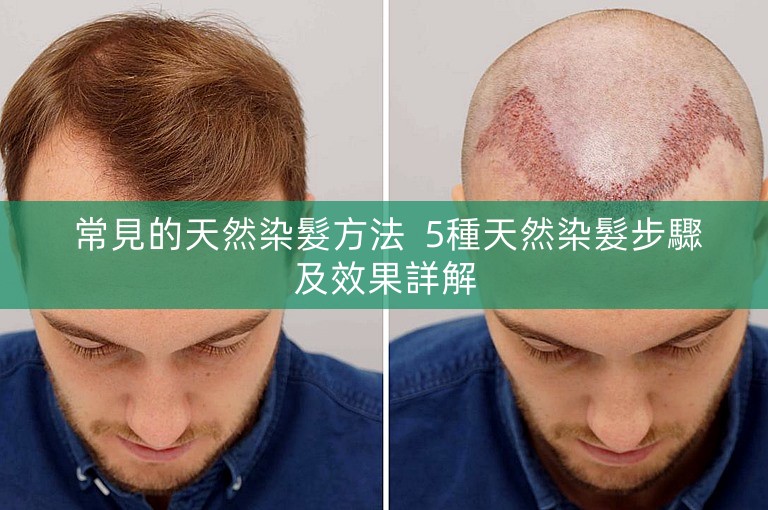 常見的天然染髮方法 5種天然染髮步驟及效果詳解 常見的天然染髮方法 5種天然染髮步驟及效果詳解