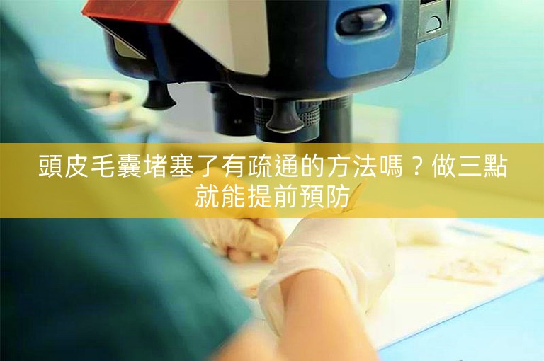 頭皮毛囊堵塞了有疏通的方法嗎？做三點就能提前預防