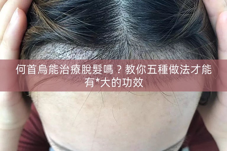 何首烏能治療脫髮嗎？教你五種做法才能有*大的功效