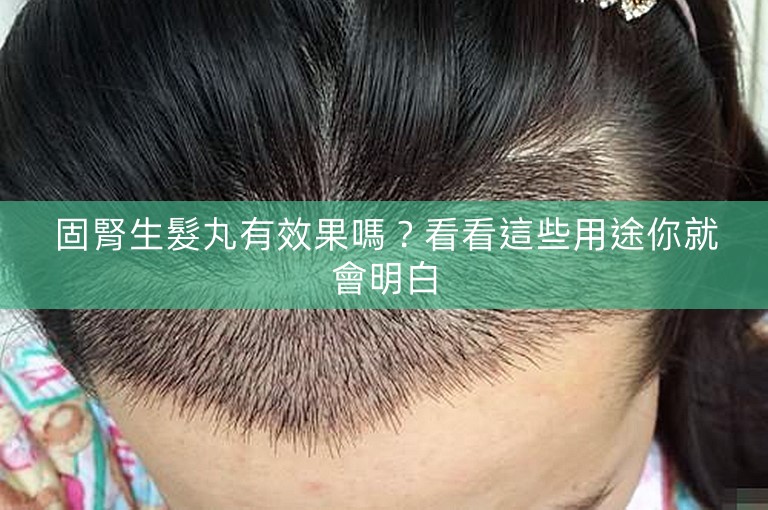 固腎生髮丸有效果嗎?看看這些用途你就會明白 固腎生髮丸有效果嗎?看看這些用途你就會明白
