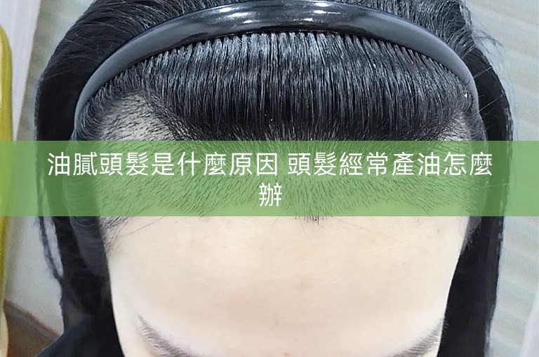 油膩頭髮是什麼原因 頭髮經常產油怎麼辦