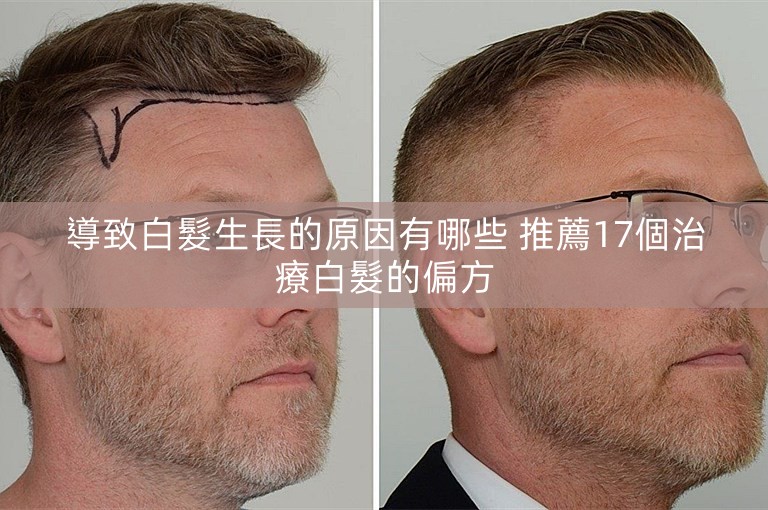 導致白髮生長的原因有哪些 推薦17個治療白髮的偏方 導致白髮生長的原因有哪些 推薦17個治療白髮的偏方