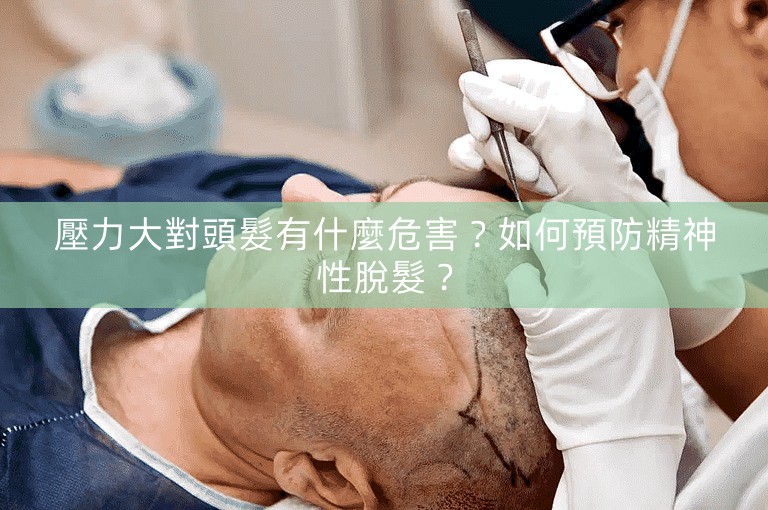 壓力大對頭髮有什麼危害？如何預防精神性脫髮？