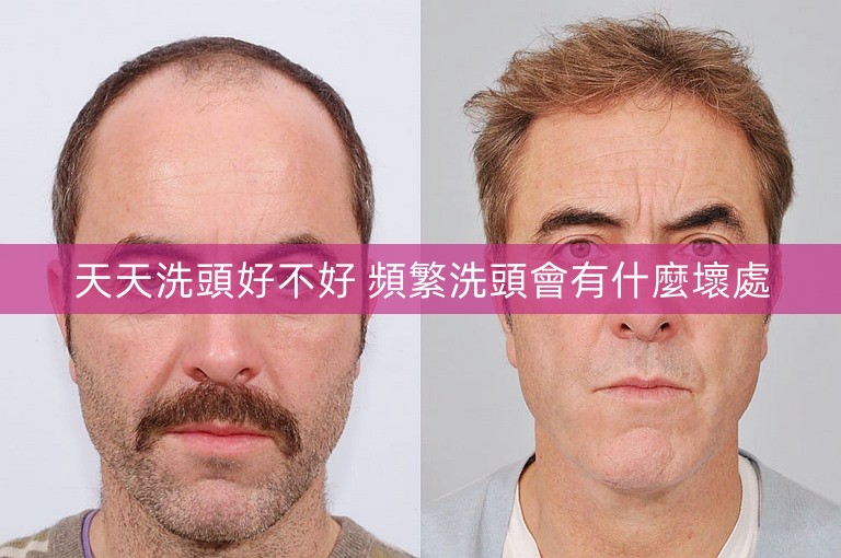 天天洗頭好不好 頻繁洗頭會有什麼壞處