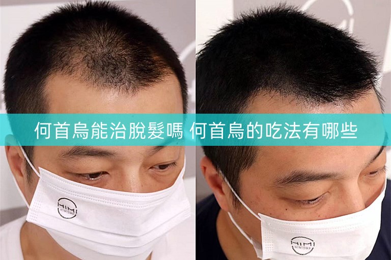 何首烏能治脫髮嗎 何首烏的吃法有哪些