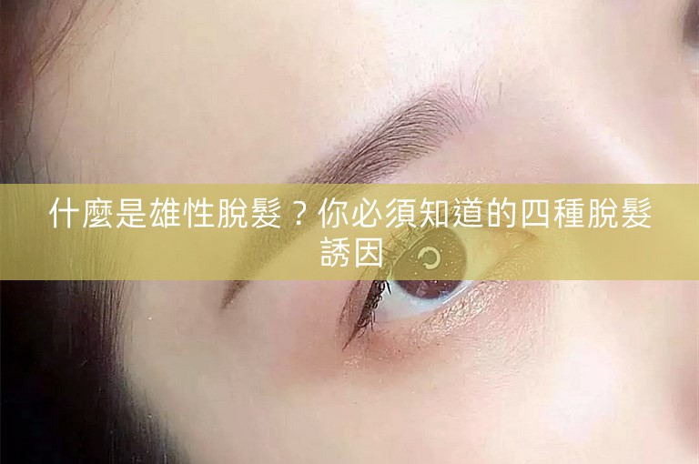 什麼是雄性脫髮？你必須知道的四種脫髮誘因