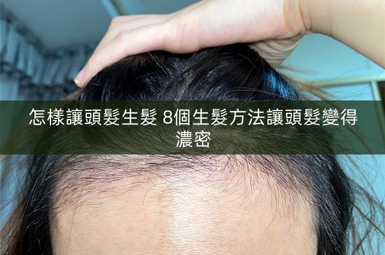 怎樣讓頭髮生髮 8個生髮方法讓頭髮變得濃密 怎樣讓頭髮生髮 8個生髮方法讓頭髮變得濃密