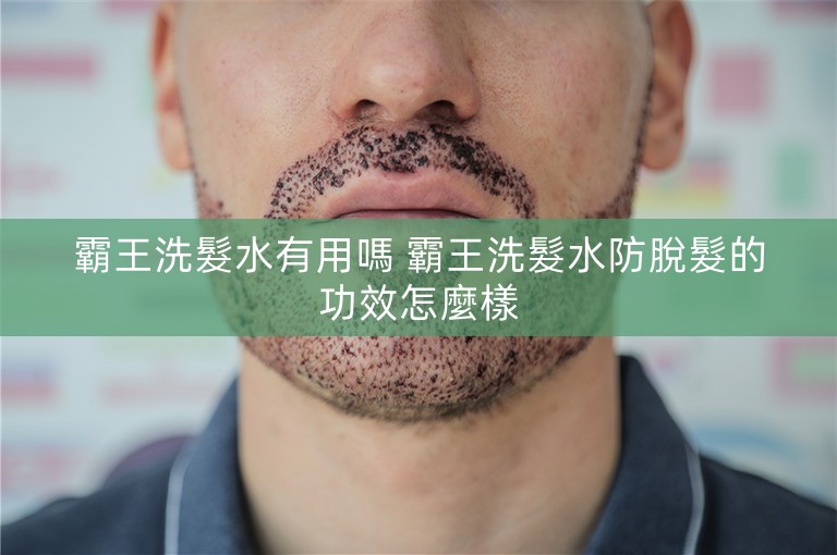 霸王洗髮水有用嗎 霸王洗髮水防脫髮的功效怎麼樣