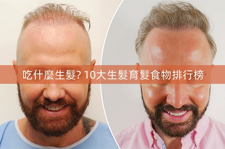吃什麼生髮? 10大生髮育髮食物排行榜