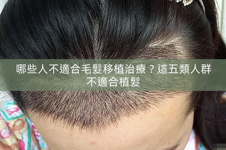哪些人不適合毛髮移植治療？這五類人群不適合植髮