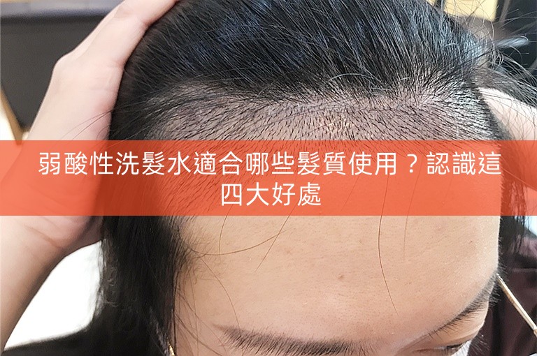 弱酸性洗髮水適合哪些髮質使用？認識這四大好處