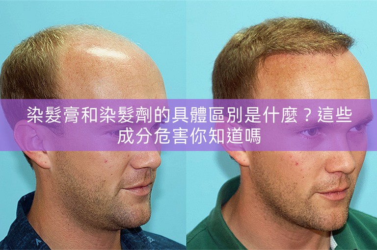 染髮膏和染髮劑的具體區別是什麼？這些成分危害你知道嗎