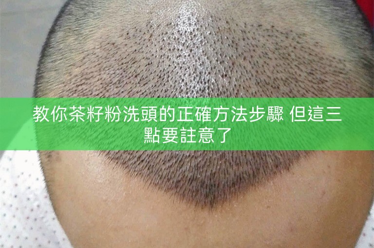 教你茶籽粉洗頭的正確方法步驟 但這三點要註意了 教你茶籽粉洗頭的正確方法步驟 但這三點要註意了