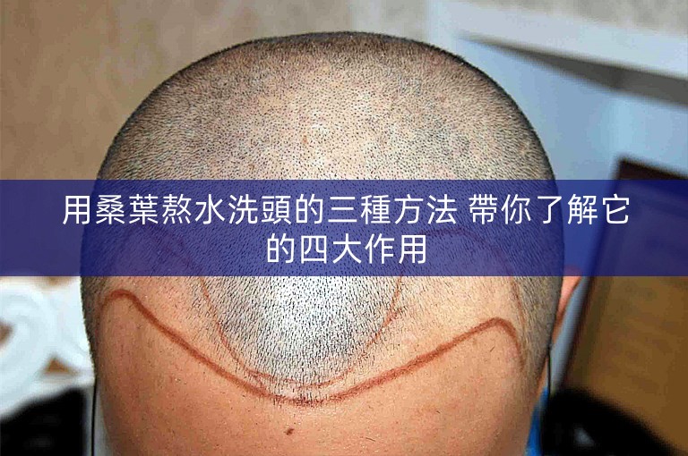 用桑葉熬水洗頭的三種方法 帶你了解它的四大作用