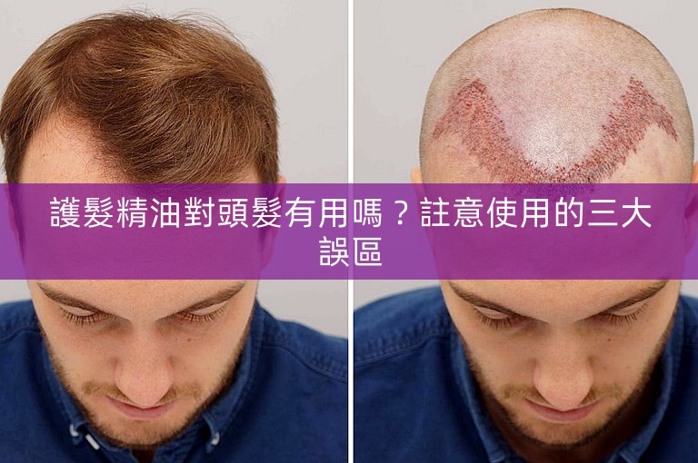 護髮精油對頭髮有用嗎?註意使用的三大誤區 護髮精油對頭髮有用嗎?註意使用的三大誤區