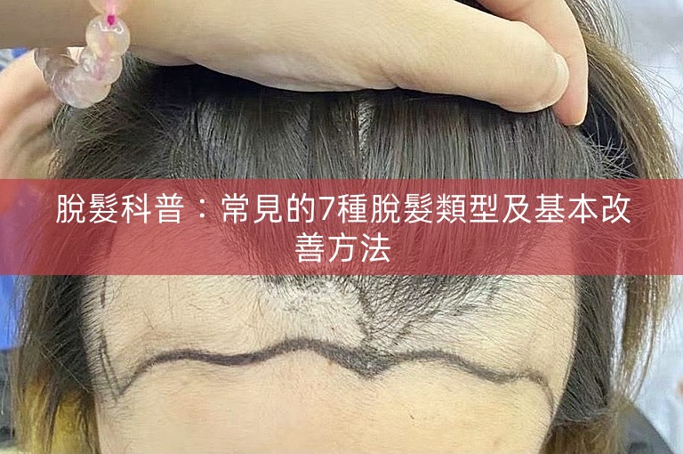 脫髮科普：常見的7種脫髮類型及基本改善方法