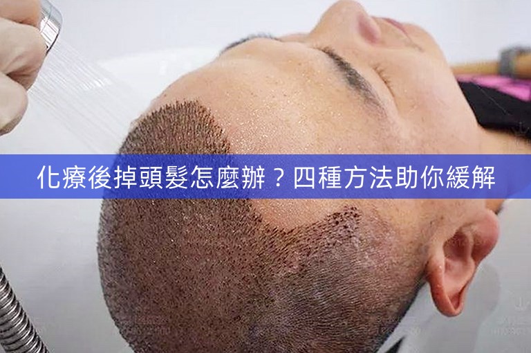 化療後掉頭髮怎麼辦？四種方法助你緩解