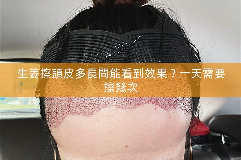 生姜擦頭皮多長間能看到效果?一天需要擦幾次 生姜擦頭皮多長間能看到效果?一天需要擦幾次