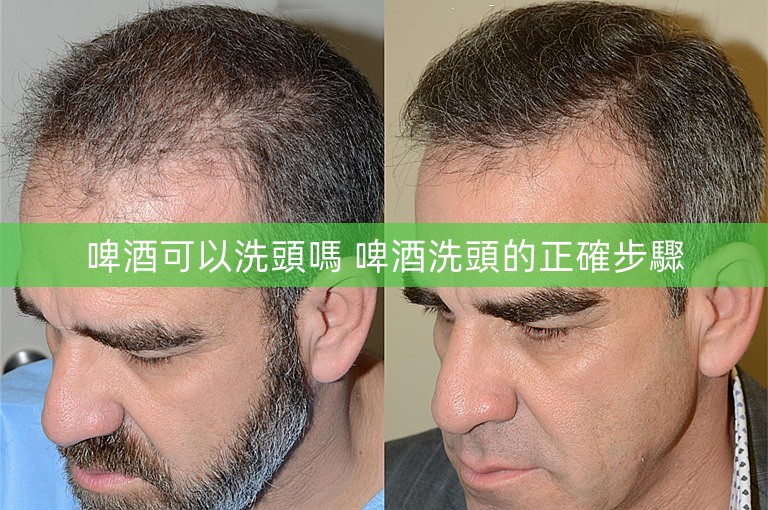 啤酒可以洗頭嗎 啤酒洗頭的正確步驟 啤酒可以洗頭嗎 啤酒洗頭的正確步驟