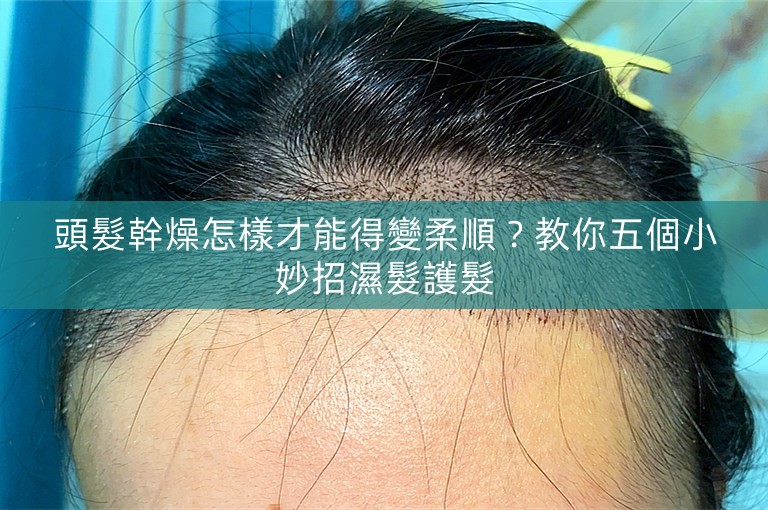 頭髮幹燥怎樣才能得變柔順？教你五個小妙招濕髮護髮