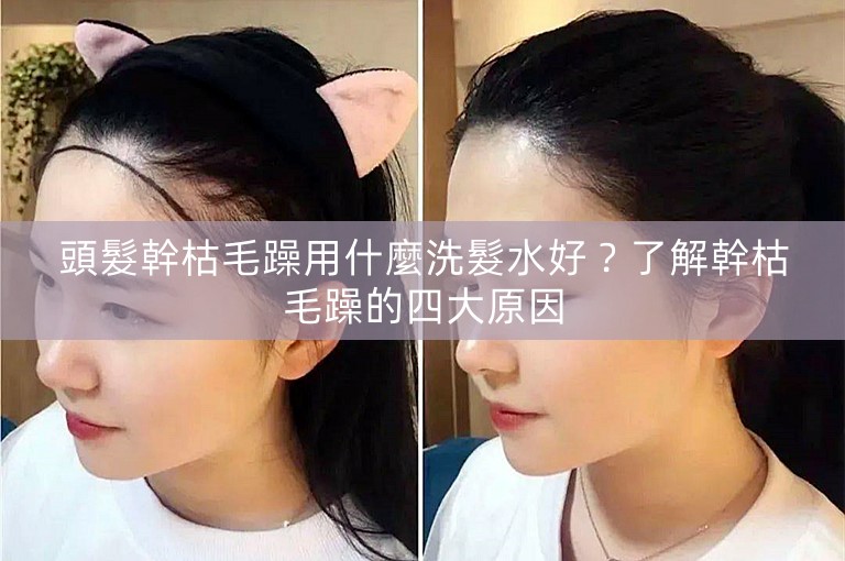 頭髮幹枯毛躁用什麼洗髮水好？了解幹枯毛躁的四大原因