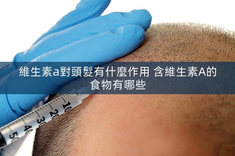 維生素a對頭髮有什麼作用 含維生素A的食物有哪些 維生素a對頭髮有什麼作用 含維生素A的食物有哪些