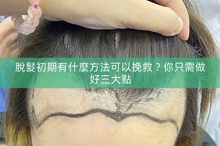 脫髮初期有什麼方法可以挽救？你只需做好三大點