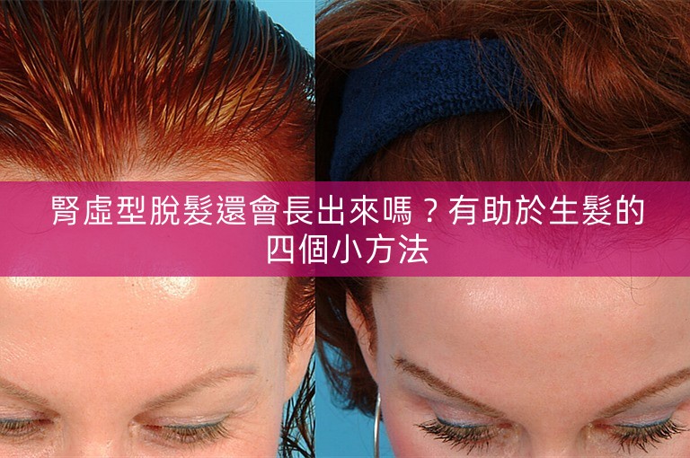 腎虛型脫髮還會長出來嗎?有助於生髮的四個小方法 腎虛型脫髮還會長出來嗎?有助於生髮的四個小方法
