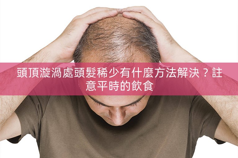 頭頂漩渦處頭髮稀少有什麼方法解決？註意平時的飲食