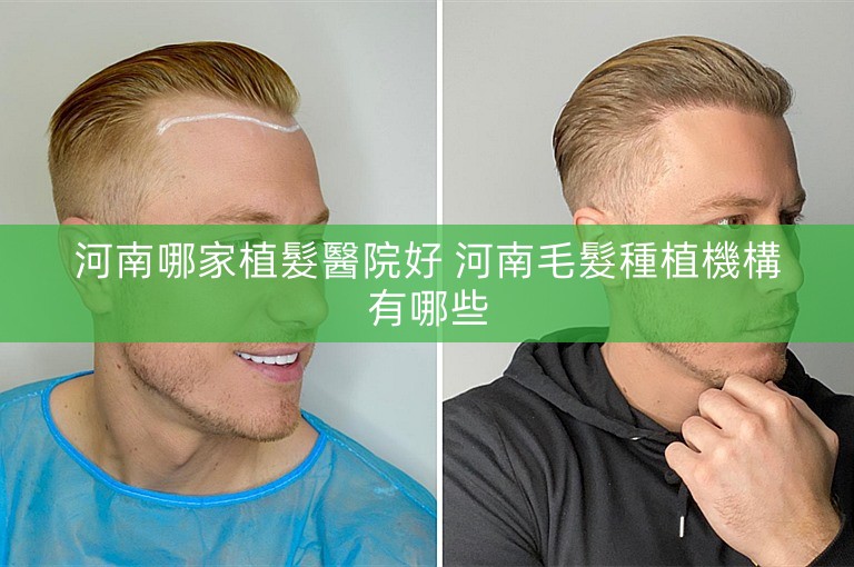 河南哪家植髮醫院好 河南毛髮種植機構有哪些