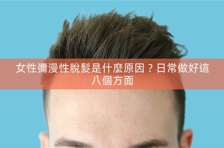 女性彌漫性脫髮是什麼原因?日常做好這八個方面 女性彌漫性脫髮是什麼原因?日常做好這八個方面