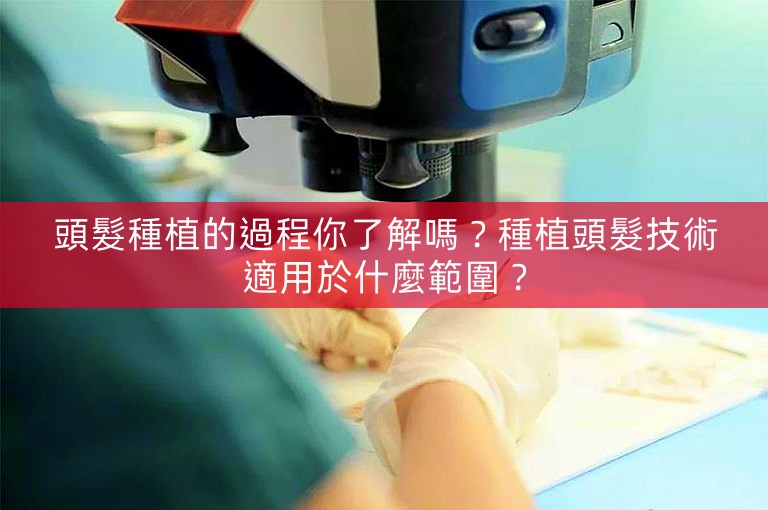 頭髮種植的過程你了解嗎？種植頭髮技術適用於什麼範圍？