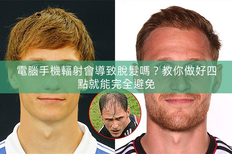 電腦手機輻射會導致脫髮嗎？教你做好四點就能完全避免