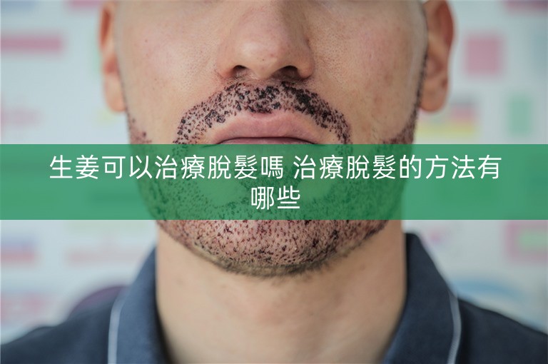 生姜可以治療脫髮嗎 治療脫髮的方法有哪些 生姜可以治療脫髮嗎 治療脫髮的方法有哪些