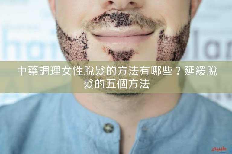 中藥調理女性脫髮的方法有哪些？延緩脫髮的五個方法