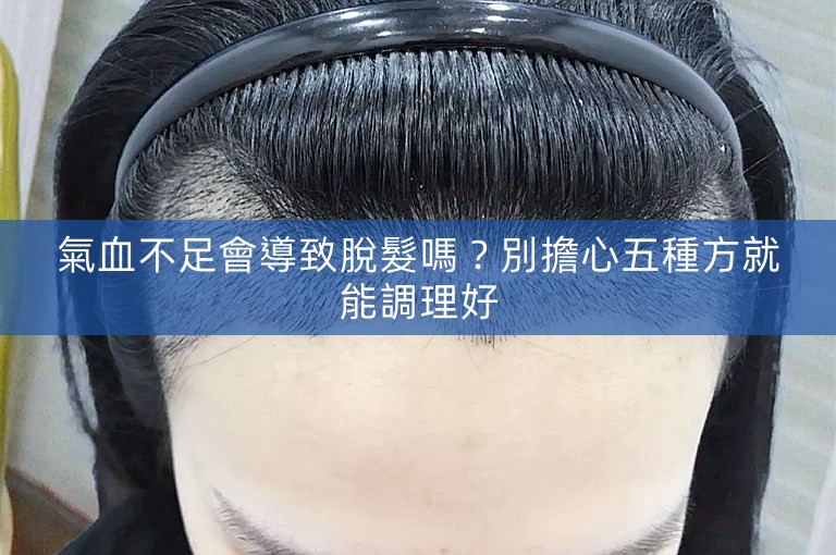 氣血不足會導致脫髮嗎？別擔心五種方就能調理好