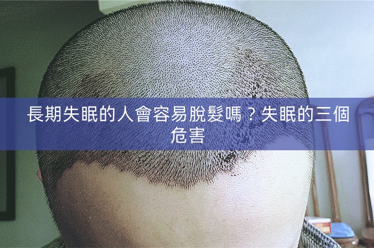 長期失眠的人會容易脫髮嗎？失眠的三個危害