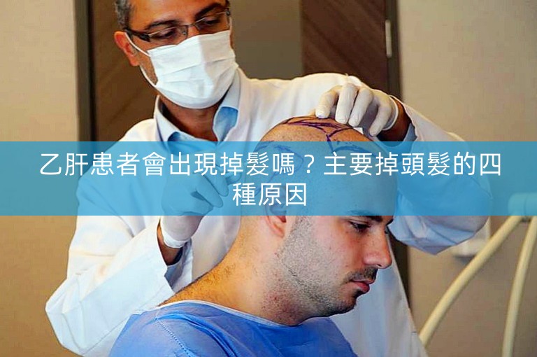 乙肝患者會出現掉髮嗎？主要掉頭髮的四種原因