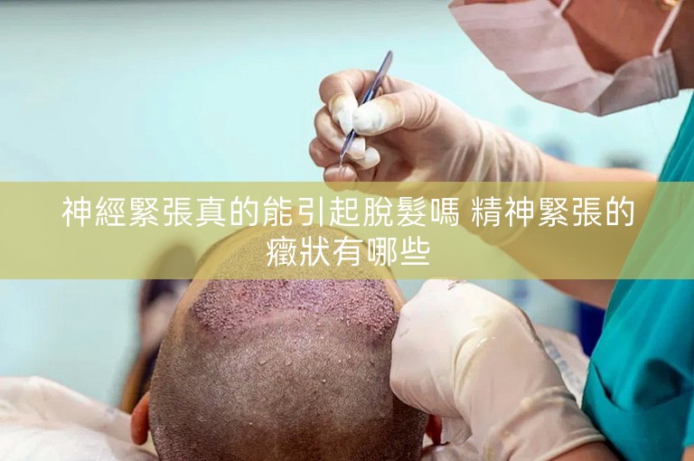 神經緊張真的能引起脫髮嗎 精神緊張的癥狀有哪些