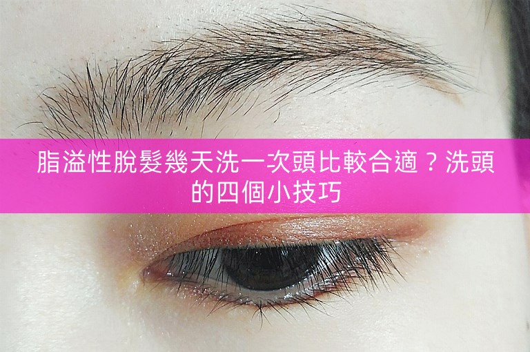 脂溢性脫髮幾天洗一次頭比較合適？洗頭的四個小技巧