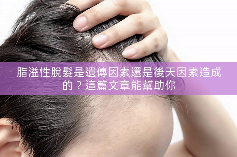 脂溢性脫髮是遺傳因素還是後天因素造成的？這篇文章能幫助你