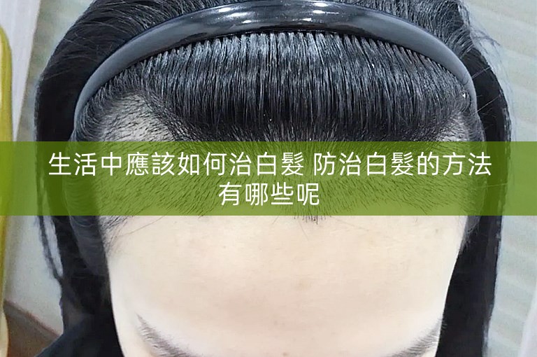 生活中應該如何治白髮 防治白髮的方法有哪些呢