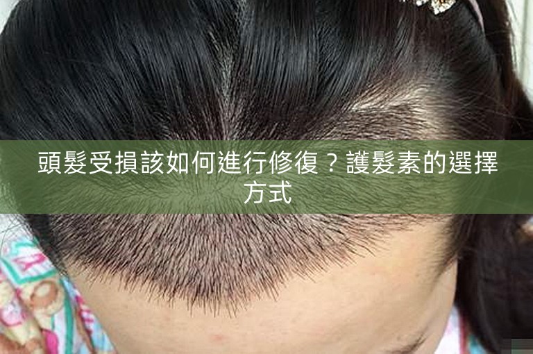 頭髮受損該如何進行修復?護髮素的選擇方式 頭髮受損該如何進行修復?護髮素的選擇方式