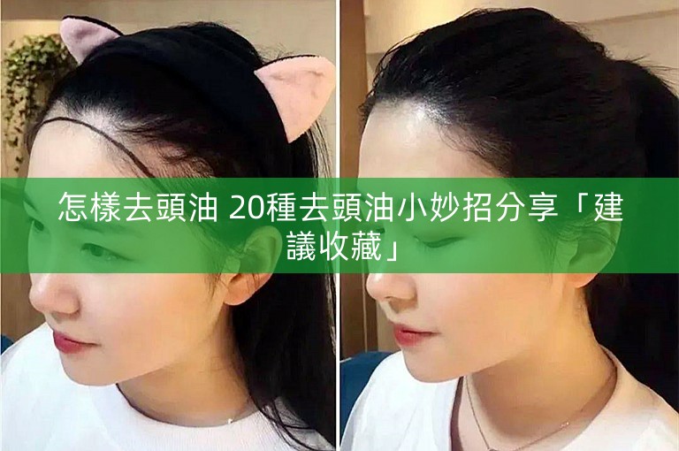 怎樣去頭油 20種去頭油小妙招分享「建議收藏」 怎樣去頭油 20種去頭油小妙招分享「建議收藏」